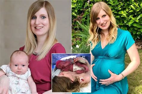 Woman shares what its like being born with two vaginas and